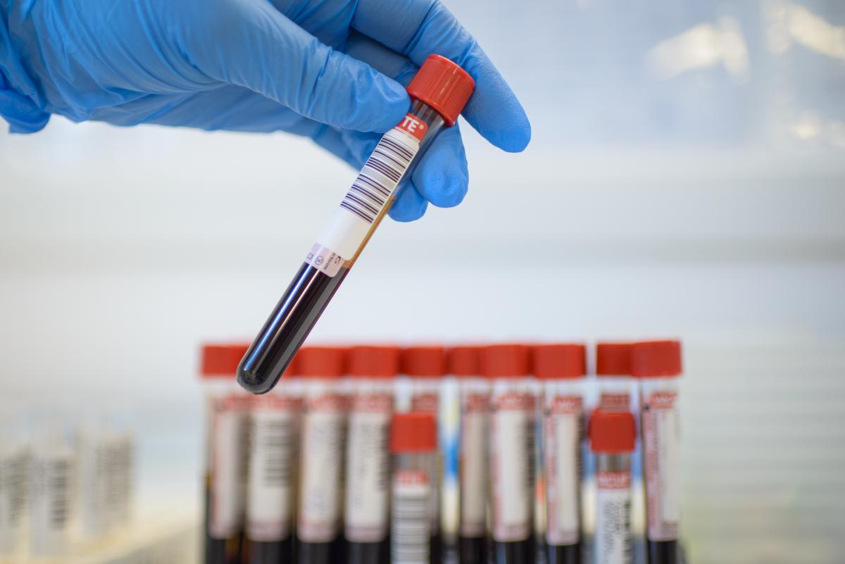 Ministerul Sănătății a anunțat teste complet gratuite pentru hepatita B și C Ministerul Sănătății a anunțat teste complet gratuite pentru hepatita B și C